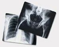 PT# -EBA6A X-Ray Film Blue 800 Speed 10x12 100/Bx by, Agfa Corporation