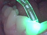 Light Therapy Dental Treatment