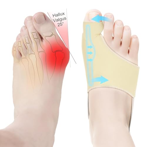 2Pcs Bunion Corrector for Women & Men Big Toe Straightener-Bunions Correction Women & Men-Bunion Splint-Bunions Pads for Bunion Relief-Hallux Valgus Pain Relief,Comfortable & Breathable for Day/Night