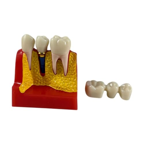 Generic 4 Times Tooth Model Oral Hygiene Preventive Care,Teaching Model for Students