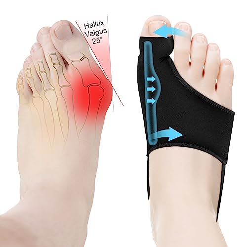 HLOES Bunion Corrector for Women & Men Big Toe Straightener-Bunions Correction Women & Men-Bunion Splint-Bunion Pads for Bunion Relief-Hallux Valgus Pain Relief,Comfortable & Breathable for Day/Night