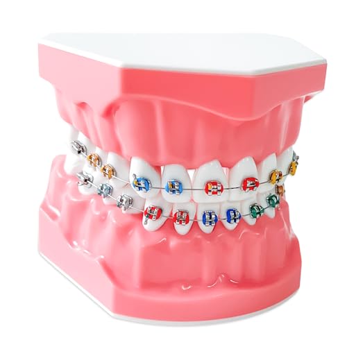 Orthodontic Dental Model with Brackets for Educational Demonstration - Silicone Teeth Typodont with Braces, Anatomic Teaching Tool - Dental Care Training Device for Students and Patients