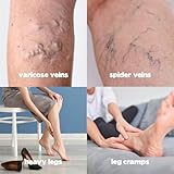 HillVital Varicose Veins Treatment for Legs, Natural Varicose Vein Cream & Spider Vein Treatment for Legs and Other Body Parts, Premium Horse Chestnut Cream for Puffed Veins, Infused with 14 Herbs