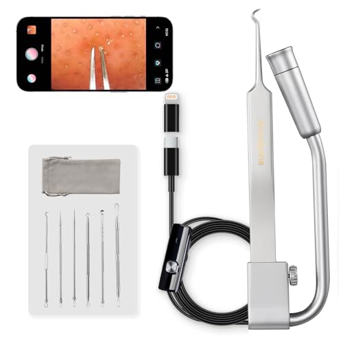 Luma 1 Visual Blackhead Remover Tweezers with Camera - Pimple Popper Tool with Camera 20x Magnification, 1080P, 8 LED Lights, with Blackhead Remover Pimple Popper Tool Kit (6 Piece Kit)