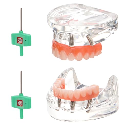 PER4MANCE Dental Implant Model: All-on-4 Dental Implants Model with Transparent Base and Removable Crown, Included with Upper & Lower Jaw
