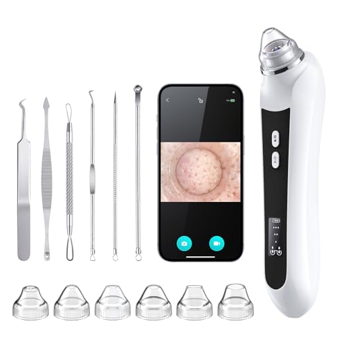 Multi-Functional Blackhead Suction Device - Gentle & Effective Skin Care, 6 Suction Heads & 3 Modes for Deep Pore Cleaning(Black)