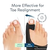 Caretras 2-Pack Bunion Corrector for Women & Men, Orthopedic Bunion Splint for Hallux Valgus Pain Relief, Big Toe Separator, Adjustable Day/Night Support, Comfortable Hammer Toe Straightener