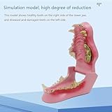 VEraiz Pathological Dog Tooth Model, Canine Teeth Anatomy Model, Animal Dental Anatomy Model for Veterinary Learning Teaching Educational Display Tool