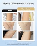 INNZA Laser Hair Removal with Ice Cooling Care Function for Women Permanent,999,999 Flashes Painless IPL Hair Remover, Hair Removal Device for Armpits Legs Arms Bikini Line (1-White)