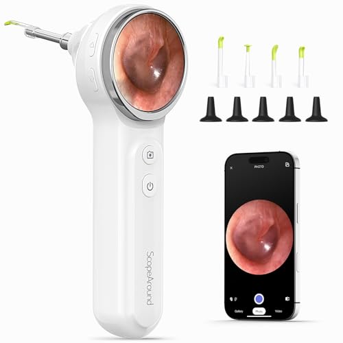 ScopeAround Digital Otoscope with 1.85 in IPS Screen, 1080p FHD Smart Visual Ear Camera, Ear Scope with Gyroscope, Wireless Otoscope with 6 LED Lights, Compatible with Android/iPhone