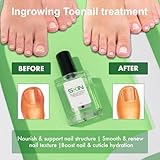 Skinapeel Toe Nail Softener & Ingrowing Toenail Prevention Oil 15ml - Manicure Nourisher Cuticle Revitalizer Natural Treatment