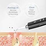 COSBEAUTY Skin Scrubber Face Spatula, Blackhead Remover Pore Cleaner Comedo Extractor with 4 Modes, Waterproof IPX6, Wireless Rechargeable (Black)