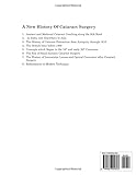 The History of Intraocular Lenses and Optical Correction after Cataract Surgery (A New History of Cataract Surgery)