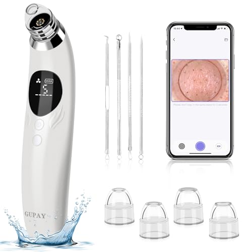 Blackhead Remover Vacuum, Pore Vacuum with 1080p HD Camera, Visible Facial Pore Cleanser with 4 Suction Heads, 5 Speeds, Black Head Remover Tool Pimple Acne Whitehead Extractor Kit (White)