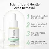 LANBENA 10% Salicylic Acid Serum, Acne Repair, Dead Skin Peels, Relieve Redness, Soothing Calming for Acne Prone Sensitive Facial Skin Care