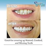 Instant Smile Comfort Fit Flex - Bright Shade - Upper Veneer Cosmetic Teeth