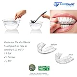 The ConfiDental - Pack of 5 Moldable Mouth Guard for Teeth Grinding Clenching Bruxism, Sport Athletic, Whitening Tray, Including 3 Regular and 2 Heavy Duty Guard (3 (lll) Regular 2 (II) Heavy Duty)