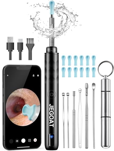 Ear Wax Removal Tool Camera, Ear Cleaner with Camera, 1296P HD Ear Scope, 6 LED Lights and 12 Ear Picks, Earwax Removal with Otoscope, Jet Black