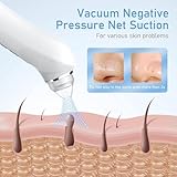 Blackhead Remover Vacuum, USB Interface Type Pore Vacuum, Black Head Extractions Tool with Camerafor, Men and Women Pore Cleaner, 3 Adjustment Modes & 6 Suction Heads(Light Pink)