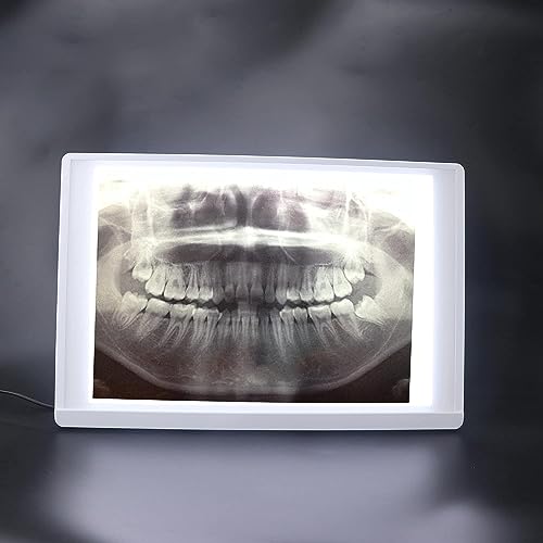 Global-Dental Lab Equipment X-Ray Film Illuminator Light Box X-ray Viewer Light Panel Screen