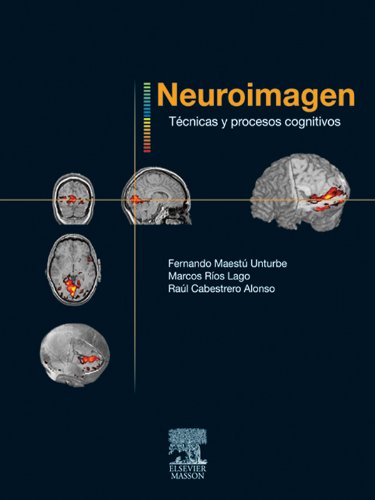 Neuroimagen. Técnicas y procesos cognitivos (Spanish Edition)