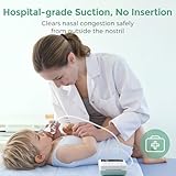 Momcozy Nasal Aspirator for Baby, [Hospital Grade] 70kPa Electric Nose Aspirator for Toddler, Baby Nose Sucker with 9 Suction Levels, Automatic Nose Cleaner with 3 Silicone Tips, 9 Music and 3 Lights