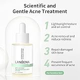 Acne Treatment Face Serum, 10% Salicylic Acid, Pimples Remover & Dead Skin Peels, Relieve Redness Rosacea Blemish, Centella Asiatica Soothing Calming, Acne Prone Sensitive Facial Skin Care, 30ml