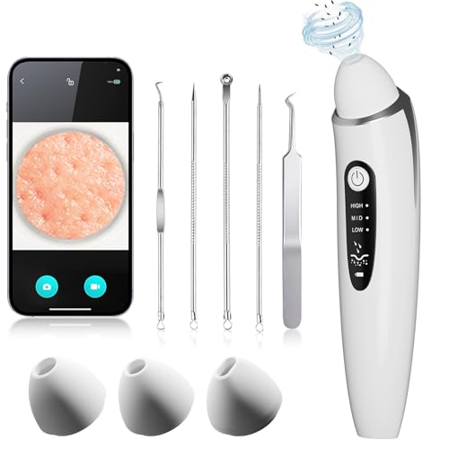 Helcona Pore Vacuum Blackhead Remover: HD Camera Electric Face Skin Care Nose Black Head Removal Facial Pimple Extractor with 3 Silicone Suction Heads & 5 Stainless Pimples Remove Tools Kit (White)