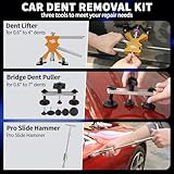 Super PDR Paintless Dent Repair Kit 148PCS Dent Puller Kit with LED Light Board Can Removal 99% of Car Dents in 30 Minutes for Repair Work of Big Dents, Small Dents, Door Ding, Creases and Hail Damage