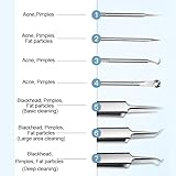 Acssart Blackhead Tools,Acssart Tweezers,Stainless Steel Blackhead Remover Tool Kit, 7 PCS Stainless Steel Blackhead Remover Kit Tool