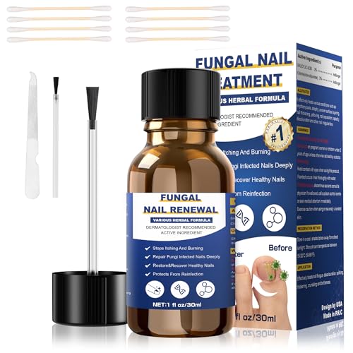 Toenail Fungus Treatment,Foot Fungus Treatment Extra Strength,Fungus Nail Treatment,Nail Fungus Treatment For Toenail, Toe Nail Fungus Treatments For Fungi Nail yellow toenail treatment(1fl oz/30ml)