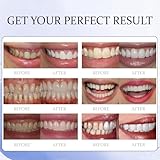 Temporary Veneers Kit for Women and Men, Tooth Replacement Kit, Nature and Comfortable Temporary Kit M