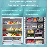 Diskary Fridge Organizer, Stackable Refrigerator Organizer Bins, Reusable Food Storage Containers, Fridge Drawer Organizer in Home Kitchen, Barbecue Shop, Restaurant, BPA-Free (2 Drawers, Large)