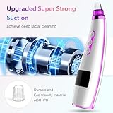 Blackhead Remover Pore Vacuum Upgraded Facial Pore Cleaner Electric Comedone Whitehead Extractor Tool-5 Suction Power,5 Probes,USB Rechargeable Blackhead Vacuum Kit for Women & Men