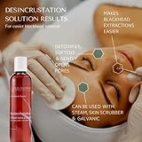 RD ALCHEMY - Desincrustation Solution/Scaling Fluid to help soften and open pores, remove blackheads and to make extractions easier. Perfect for Estheticians or home use