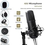 Podcast Equipment Bundle, 48V XLR Podcast Microphone Bundle, Voice Changer with Adjustable Mic Stand, Studio Condenser Microphone for Smartphone, PC, DJ, Video Recording, Streaming, Gaming and Singing