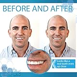 Instant Smile Complete Your Smile Temporary Tooth Replacement Kit - Replace a Missing Tooth in Minutes - Patented