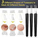 Pimple Popper Tool Kit, IUMAKEVP 15 PCS Professional Stainless Steel Blackhead Remover Comedone Extractor Tools for Removing Pimples, Blackheads, Zit on Face - Acne Removal Kit with Metal Case (Black)